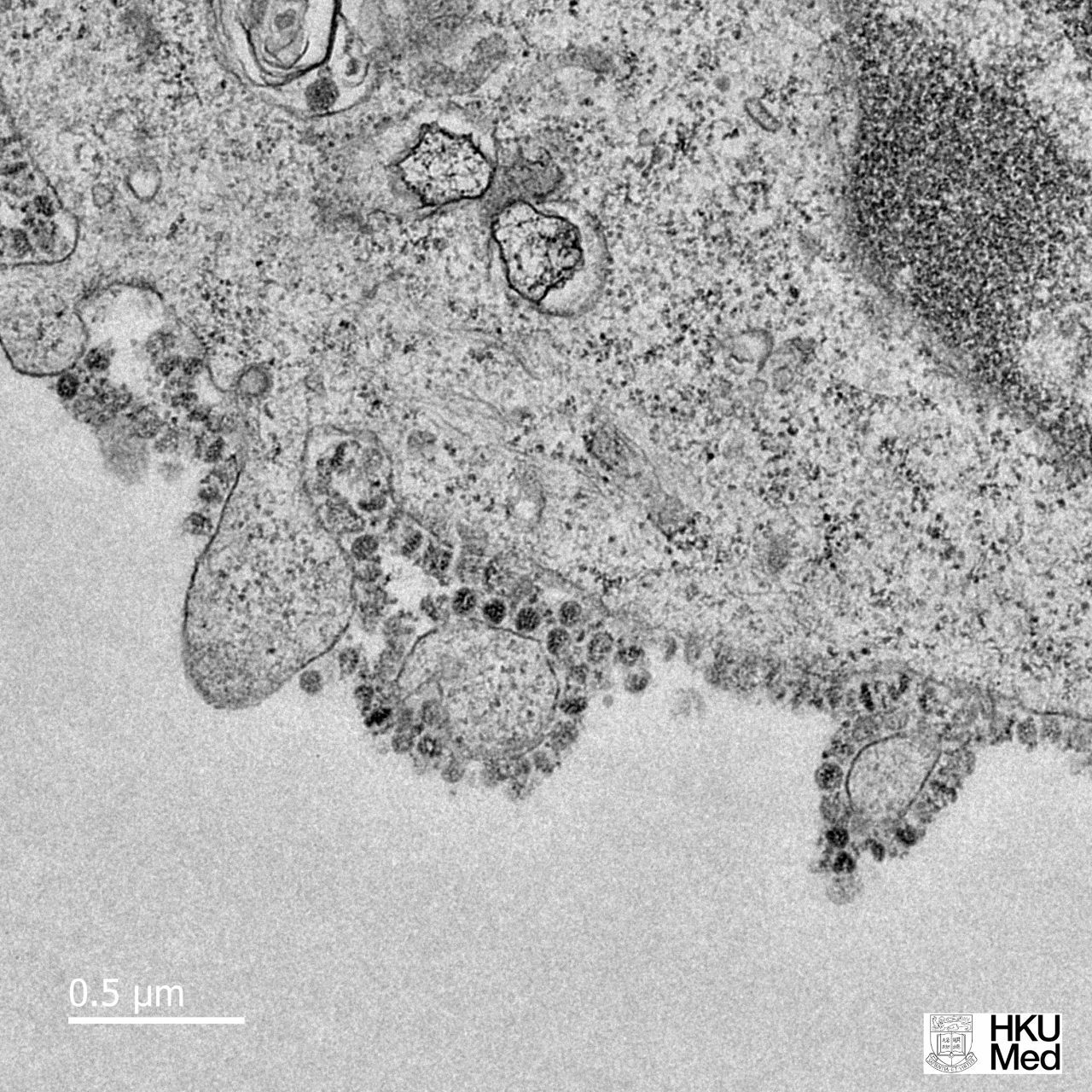 証券会社の注目記事はどうか By Jason Gale 2020年1月31日 17:34 JST Here Are the First Images of How Coronavirus Replicates in Cells 香港大学、新型コロナウイルスの体内細胞内での増殖画像を公開 感染した細胞から数千のウイルス粒子が他の細胞に感染・増殖