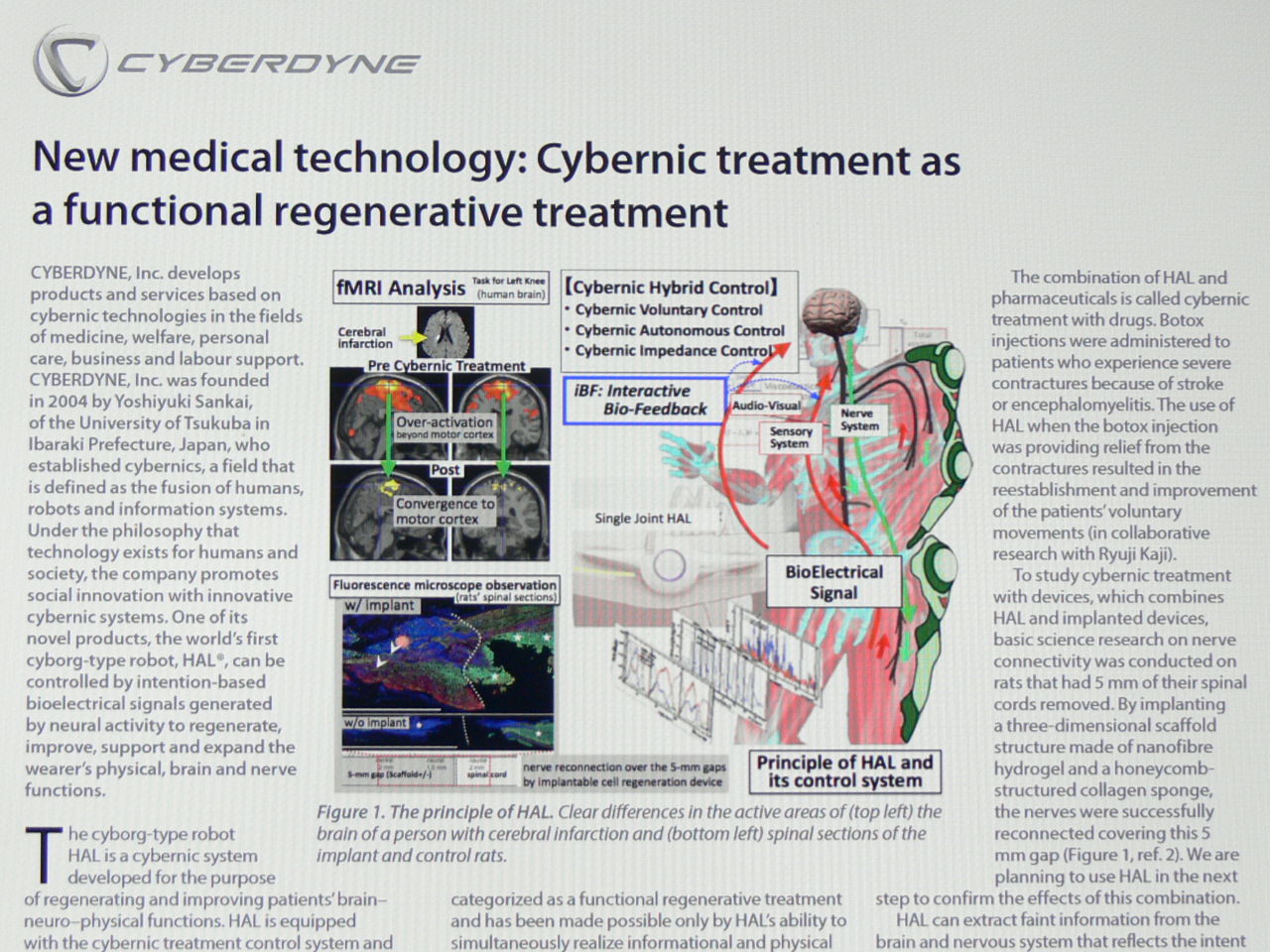 No.127401 当社紹介記事 「New me… - CYBERDYNE(株)【7779】の掲示板 2016/12/04〜2016/12 ...