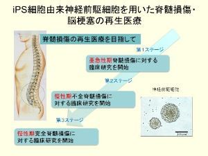 サンバイオの未来を考える掲示板 慶応大学の岡野栄之氏はiPS細胞を利用して各種の問題に取り組んでいる様子、期待できそうですね。関係している株式会社ケイファーマでの説明によれば、これまでの創薬研究では、そのシステムのためにヒト臨床試験の成功確率は非常に低い結果になっていたが、今は患者から頂く血液細胞からiPS細胞を樹立することから始まる方法が確立され、従来の疾患動物モデルでの評価を介さずに臨床試験に進める可能性を示す創薬研究の革新的改革と見られている。この新しい方法で一刻も早く患者を救う創薬研究を完遂させてもらいたい。サンバイオにはこの研究に助力してもらいたい。複数のアプローチがあるほうが患者のためだ。